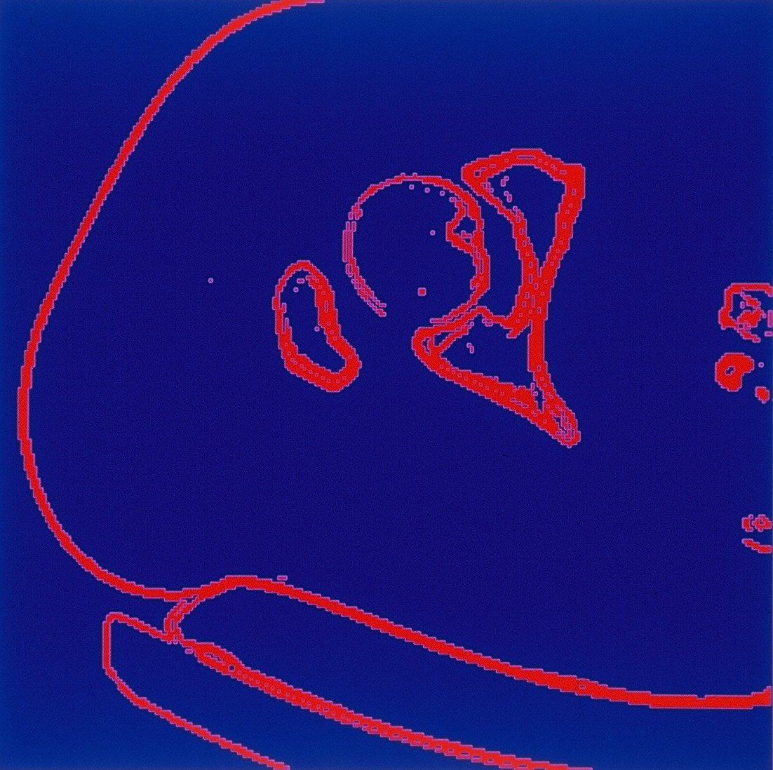 Aus CT-Bild erzeugtes Binärbild