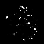 Binärdarstellung der Luftporen des Gangsystems.